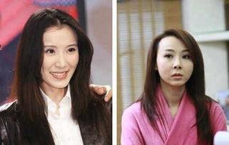 明星网红整形前照片大全,真实面貌大公开