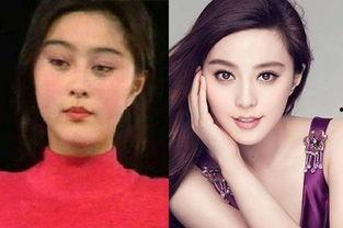 明星网红整形前照片大全,真实面貌大公开