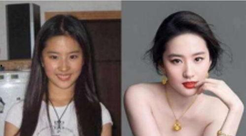 明星网红怎么脱腋毛视频,轻松告别尴尬，展现自信魅力